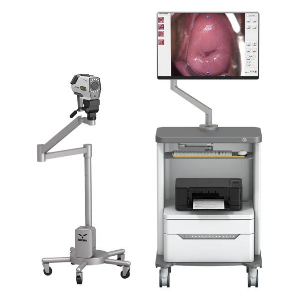 Colposcope
